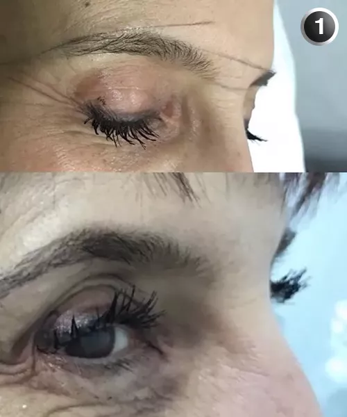 microblading01